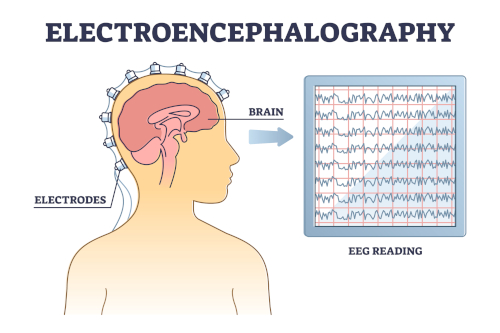 brainwaves recorded from electrodes on the scalp